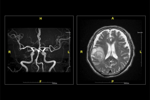 Mri ステント 2.心臓MRI検査(Cardiovascular MRI